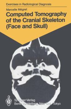 Paperback Computed Tomography of the Cranial Skeleton (Face and Skull): 58 Radiological Exercises for Students and Practitioners Book