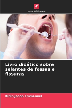 Paperback Livro didático sobre selantes de fossas e fissuras [Portuguese] Book