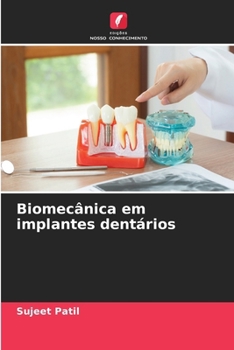 Biomecânica em implantes dentários