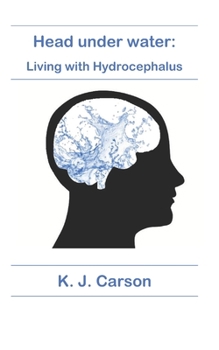 Paperback Head under water: Living with Hydrocephalus Book