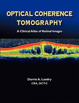 Paperback Optical Coherence Tomography a Clinical Atlas of Retinal Images Book