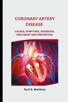 Paperback Coronary Artery Disease: Causes, Symptoms, Diagnosis, Treatment and Prevention Book