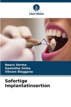 Paperback Sofortige Implantatinsertion [German] Book