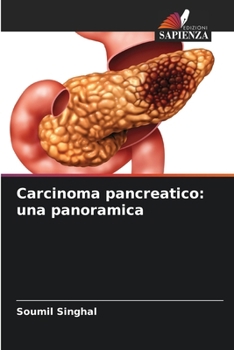 Paperback Carcinoma pancreatico: una panoramica [Italian] Book