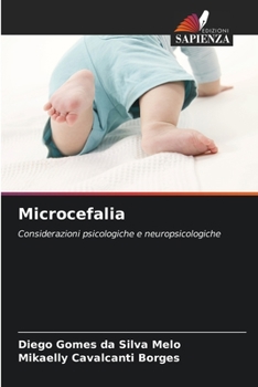 Paperback Microcefalia [Italian] Book
