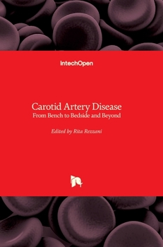 Hardcover Carotid Artery Disease: From Bench to Bedside and Beyond Book