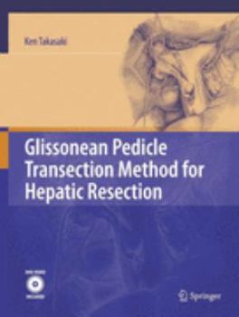 Hardcover Glissonean Pedicle Transection Method for Hepatic Resection Book