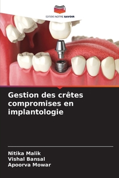 Paperback Gestion des crêtes compromises en implantologie [French] Book