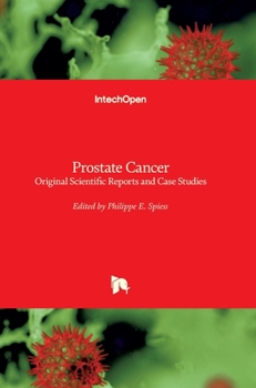 Hardcover Prostate Cancer: Original Scientific Reports and Case Studies Book