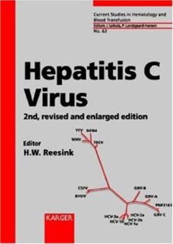 Hardcover Hepatitis C Virus (CURRENT STUDIES IN HEMATOLOGY AND BLOOD TRANSFUSION) Book