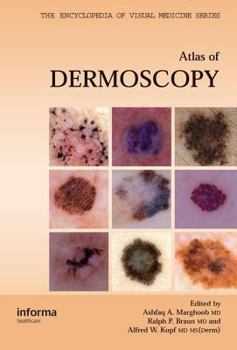 Paperback An Atlas of Dermoscopy (Encyclopedia of Visual Medicine Series) Book