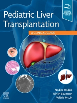 Hardcover Pediatric Liver Transplantation: A Clinical Guide Book