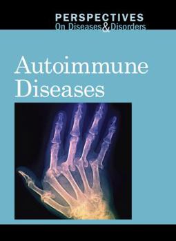 Hardcover Autoimmune Diseases Book