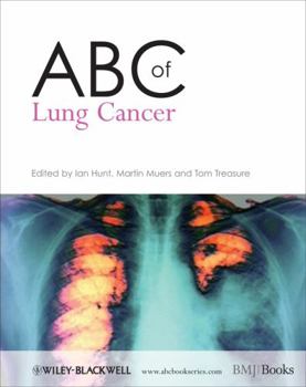 Paperback ABC of Lung Cancer Book