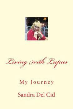 Paperback Living with Lupus Book