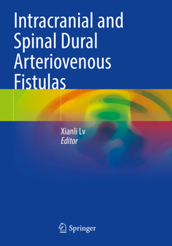 Paperback Intracranial and Spinal Dural Arteriovenous Fistulas Book