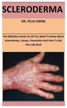 Paperback Scleroderma: The Definitive Guide On All You Need To Know About Scleroderma, Causes, Prevention And How To Get Your Life Back Book