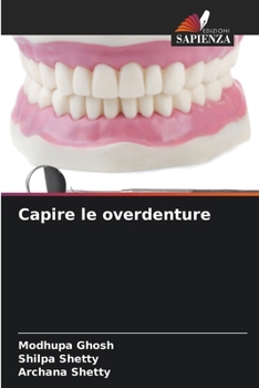 Paperback Capire le overdenture [Italian] Book