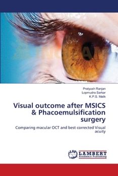 Paperback Visual outcome after MSICS & Phacoemulsification surgery Book