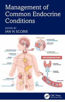Paperback Management of Common Endocrine Conditions Book