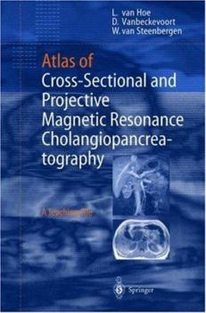Hardcover Atlas of Cross-Sectional and Projective MR Cholangiopancreatography Book