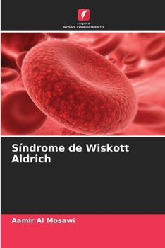 Paperback Síndrome de Wiskott Aldrich [Portuguese] Book
