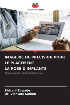 Paperback Imagerie de Précision Pour Le Placement La Pose d'Implants [French] Book
