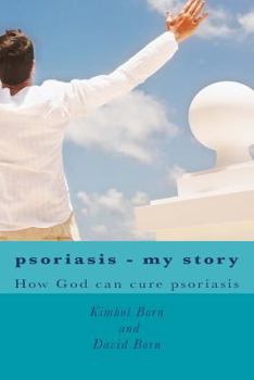 Paperback Psoriasis - my story: How God can cure your psoriasis Book