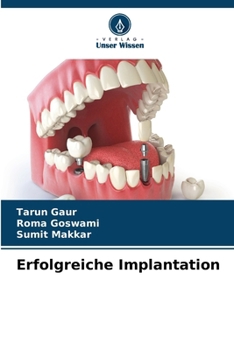 Paperback Erfolgreiche Implantation [German] Book