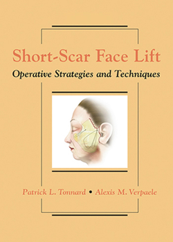 Hardcover Short-Scar Face Lift: Operative Strategies and Techniques Book