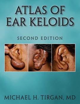 Paperback Atlas of Ear Keloids - Second Edition Book