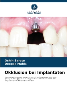 Paperback Okklusion bei Implantaten [German] Book