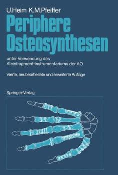 Paperback Periphere Osteosynthesen: Unter Verwendung Des Kleinfragment-Instrumentariums Der Ao [German] Book