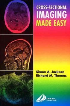 Paperback Cross-Sectional Imaging Made Easy Book
