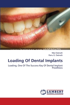 Paperback Loading Of Dental Implants Book