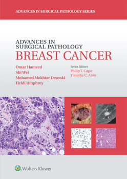 Hardcover Advances in Surgical Pathology: Breast Cancer Book