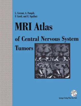 Hardcover MRI Atlas of Central Nervous System Tumors Book