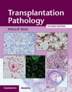 Hardcover Transplantation Pathology Hardback with Online Resource Book