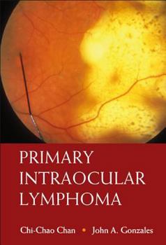 Hardcover Primary Intraocular Lymphoma Book