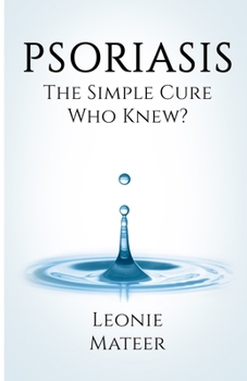 Paperback Psoriasis: The Simple Cure - Who Knew? Book