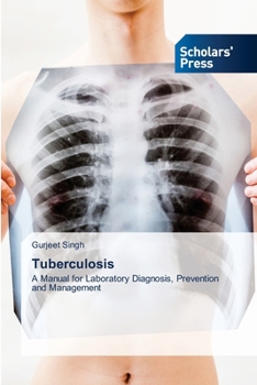 Paperback Tuberculosis Book