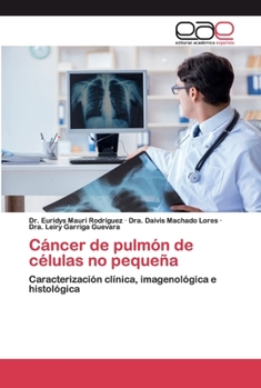 Paperback Cáncer de pulmón de células no pequeña [Spanish] Book