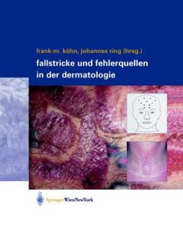 Paperback Fallstricke Und Fehlerquellen in Der Dermatologie [German] Book