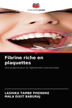 Paperback Fibrine riche en plaquettes [French] Book