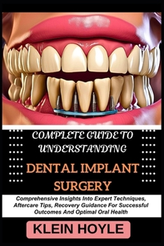 COMPLETE GUIDE TO UNDERSTANDING DENTAL IMPLANT SURGERY: Comprehensive Insights Into Expert Techniques, Aftercare Tips, Recovery Guidance For Successful Outcomes And Optimal Oral Health