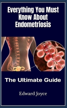 Paperback Everything You Must Know About Endometriosis: The Ultimate Guide Book