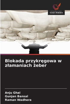 Paperback Blokada przykręgowa w zlamaniach żeber [Polish] Book