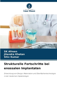 Strukturelle Fortschritte bei enossalen Implantaten (German Edition)