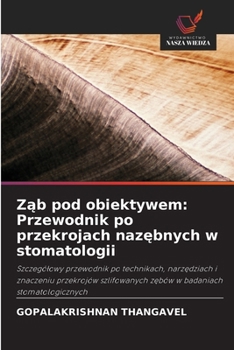 Zab pod obiektywem: Przewodnik po przekrojach nazebnych w stomatologii (Polish Edition)