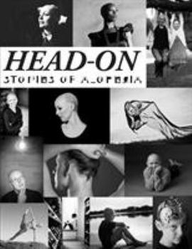 Paperback Head-On, Stories of Alopecia Book